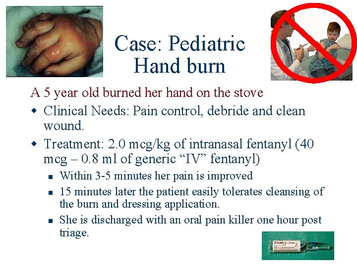 Case: Pediatric Hand burn A 5 year old burned her hand on the stove