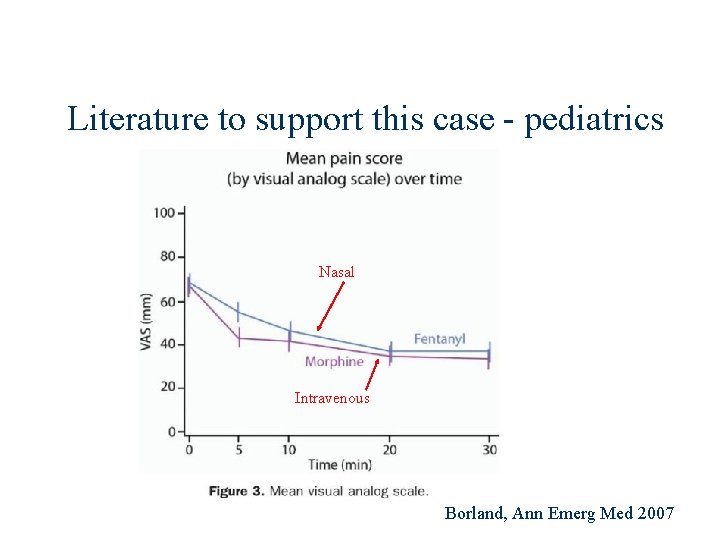 Literature to support this case - pediatrics Nasal Intravenous Borland, Ann Emerg Med 2007