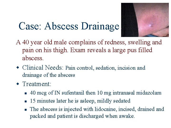 Case: Abscess Drainage A 40 year old male complains of redness, swelling and pain