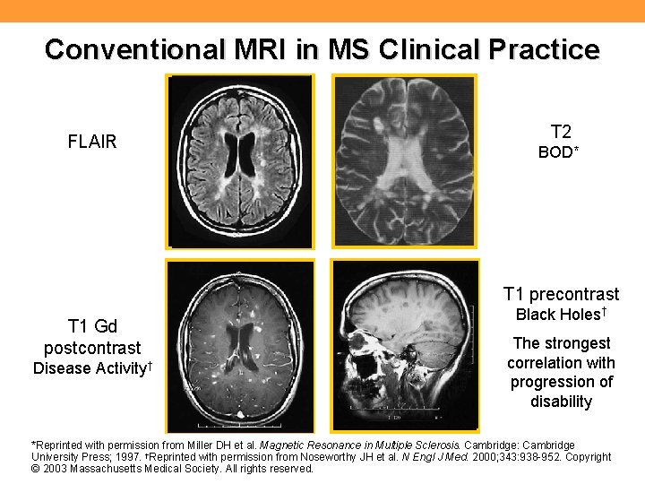 Conventional MRI in MS Clinical Practice FLAIR T 2 BOD* T 1 precontrast T