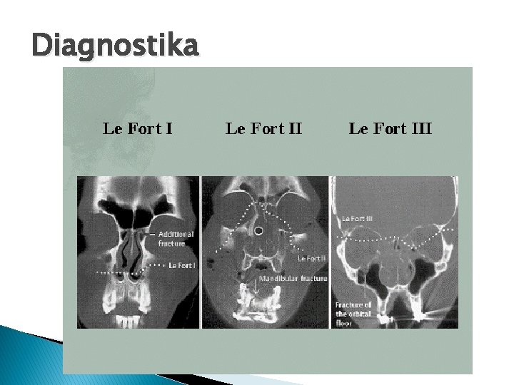 Diagnostika 