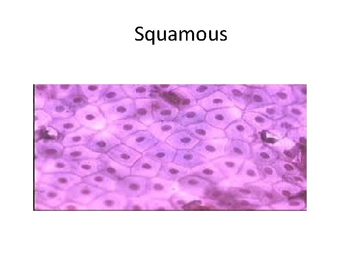 Squamous 