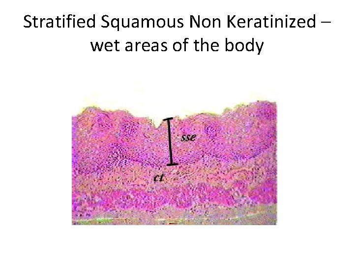 Stratified Squamous Non Keratinized – wet areas of the body 