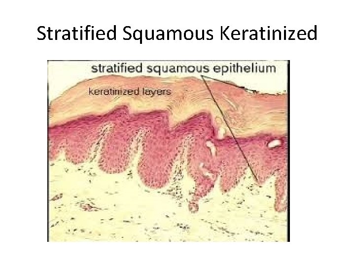 Stratified Squamous Keratinized 