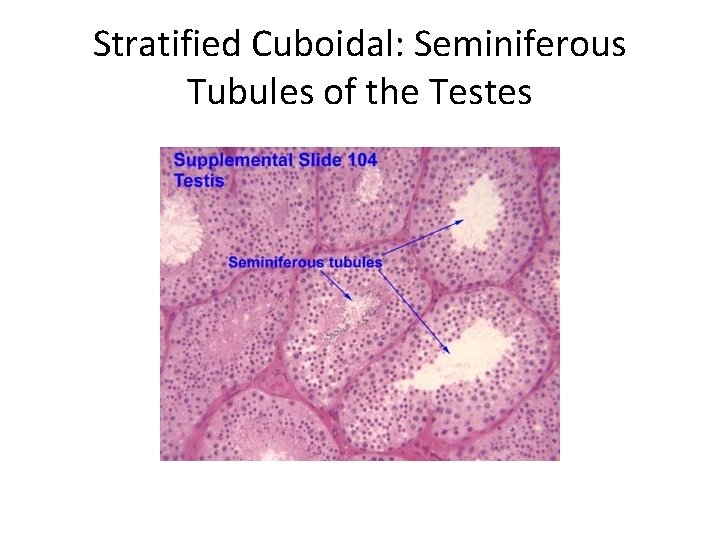 Stratified Cuboidal: Seminiferous Tubules of the Testes 