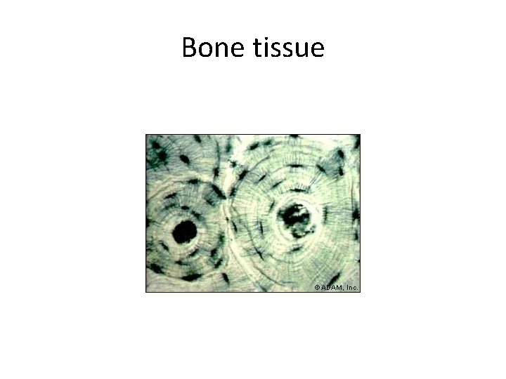 Bone tissue 
