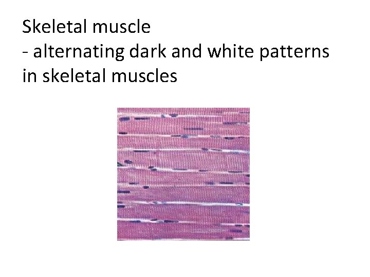 Skeletal muscle - alternating dark and white patterns in skeletal muscles 