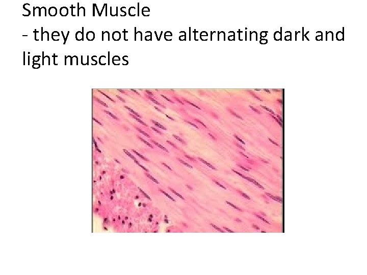 Smooth Muscle - they do not have alternating dark and light muscles 