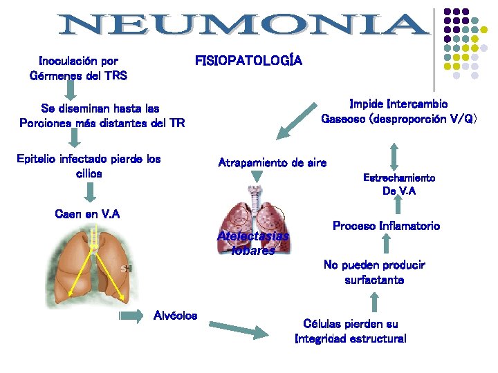 FISIOPATOLOGÍA Inoculación por Gérmenes del TRS Impide Intercambio Gaseoso (desproporción V/Q) Se diseminan hasta