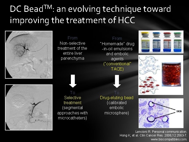 DC Bead. TM: an evolving technique toward improving the treatment of HCC From Non-selective