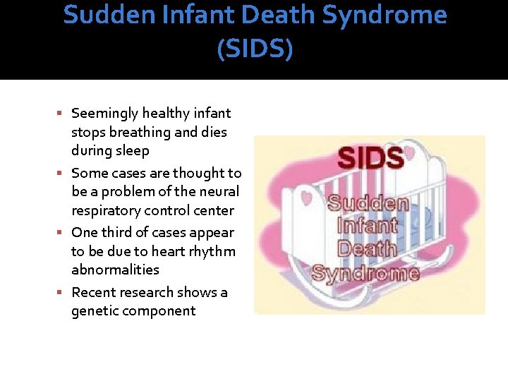 Sudden Infant Death Syndrome (SIDS) Seemingly healthy infant stops breathing and dies during sleep