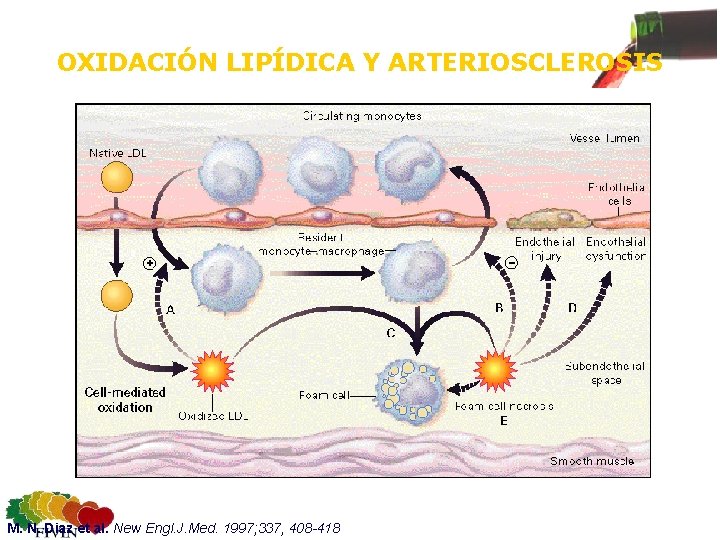 OXIDACIÓN LIPÍDICA Y ARTERIOSCLEROSIS M. N. Diaz et al. New Engl. J. Med. 1997;