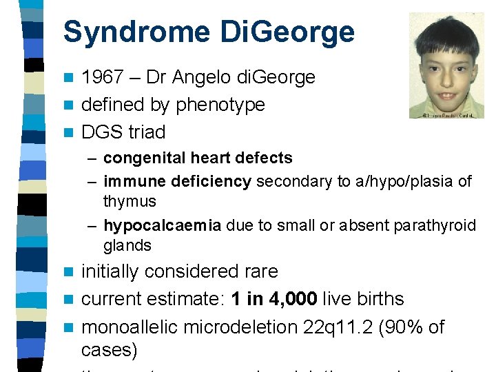 Syndrome Di. George 1967 – Dr Angelo di. George n defined by phenotype n