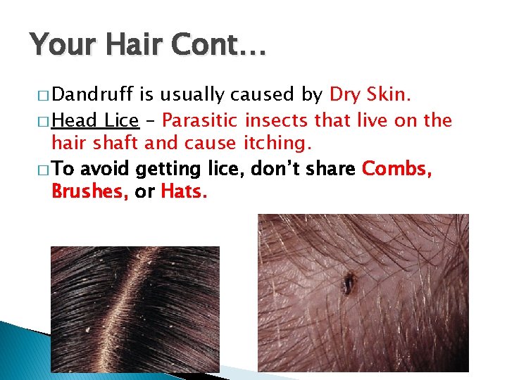 Your Hair Cont… � Dandruff is usually caused by Dry Skin. � Head Lice