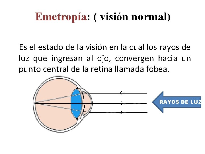 Emetropía: ( visión normal) Es el estado de la visión en la cual los