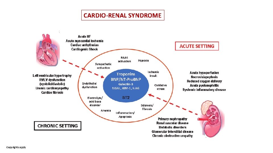 CARDIO-RENAL SYNDROME Copyrights apply 