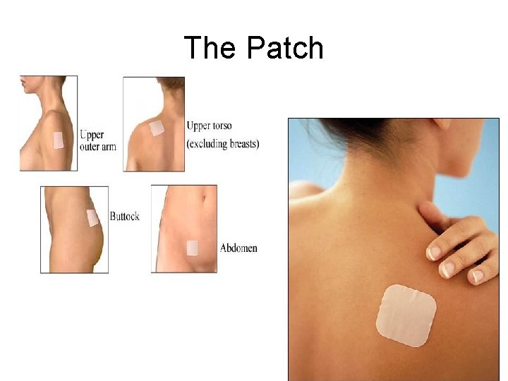 The Patch 