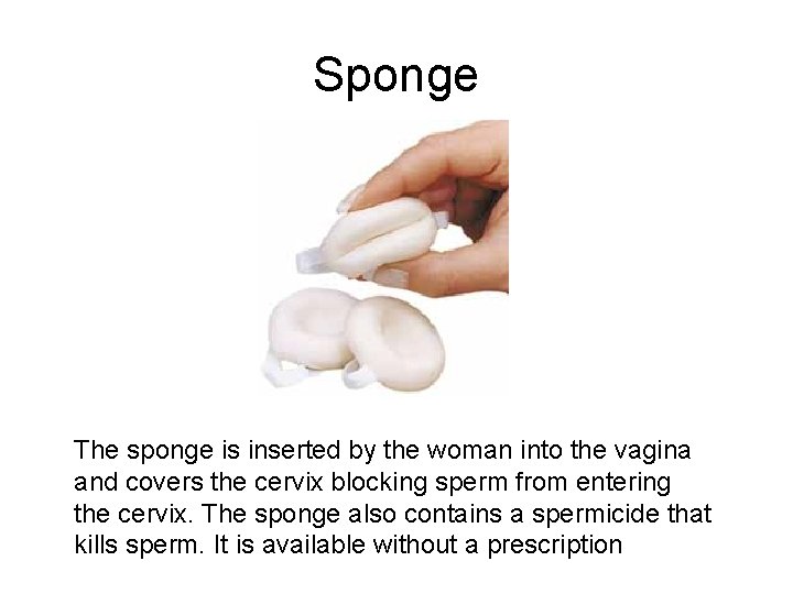 Sponge The sponge is inserted by the woman into the vagina and covers the