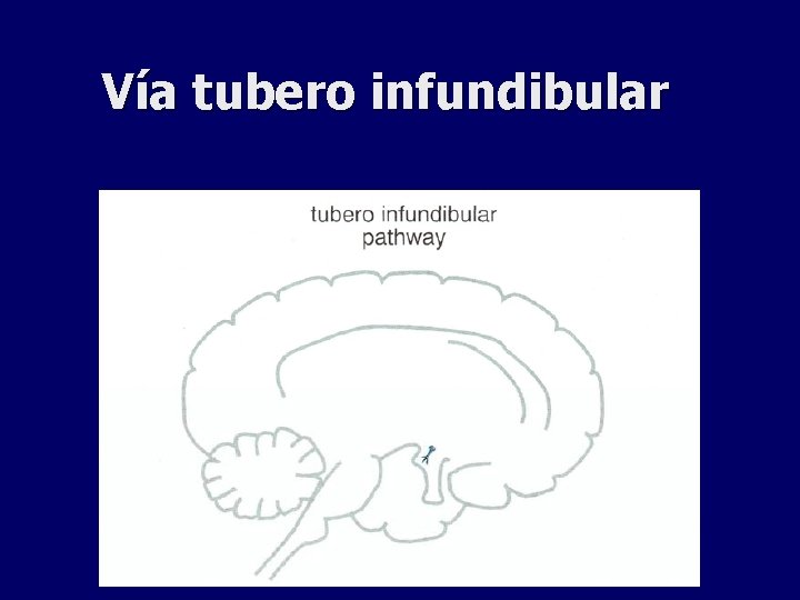 Vía tubero infundibular 