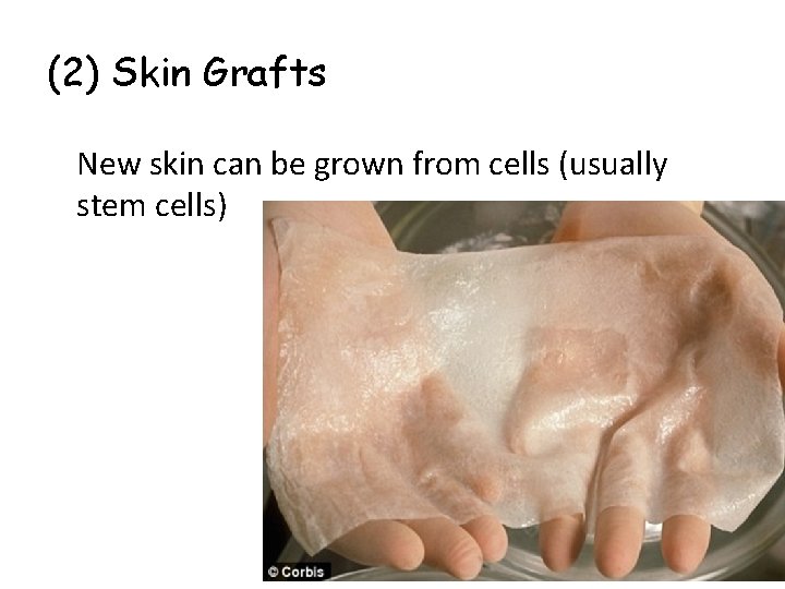 (2) Skin Grafts New skin can be grown from cells (usually stem cells) 
