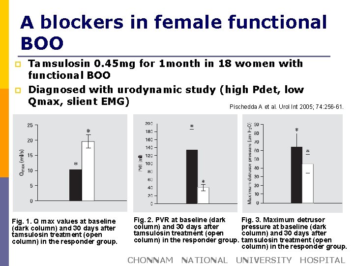 Α blockers in female functional BOO p p Tamsulosin 0. 45 mg for 1