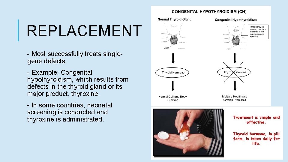 REPLACEMENT - Most successfully treats singlegene defects. - Example: Congenital hypothyroidism, which results from