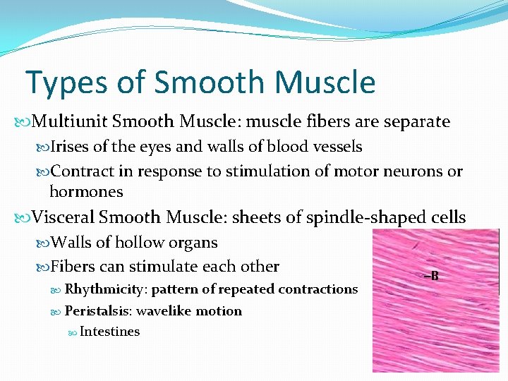 Types of Smooth Muscle Multiunit Smooth Muscle: muscle fibers are separate Irises of the