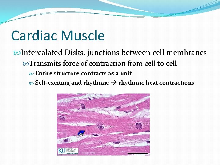 Cardiac Muscle Intercalated Disks: junctions between cell membranes Transmits force of contraction from cell