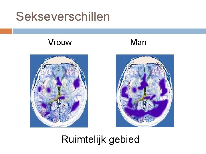 Sekseverschillen Vrouw Man Ruimtelijk gebied Sekseverschillen Vrouw Man Ruimtelijk gebied