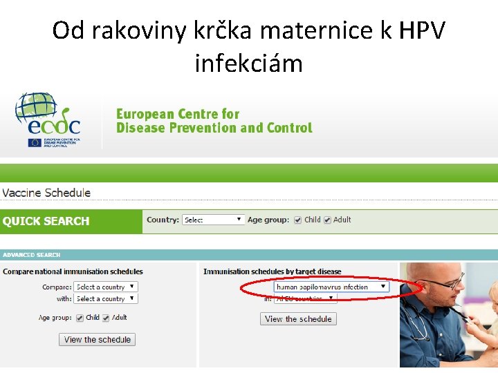 Od rakoviny krčka maternice k HPV infekciám 