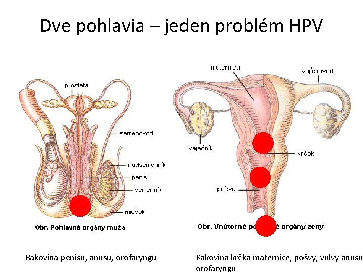 Dve pohlavia – jeden problém HPV Rakovina penisu, anusu, orofaryngu Rakovina krčka maternice, pošvy,