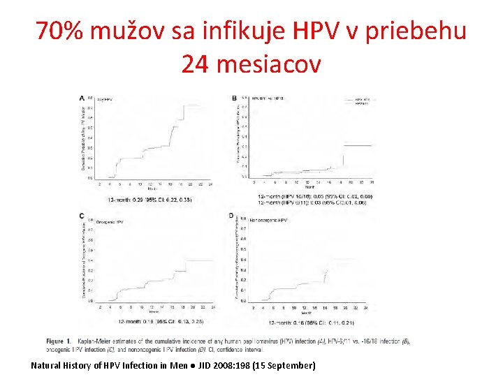 70% mužov sa infikuje HPV v priebehu 24 mesiacov Natural History of HPV Infection