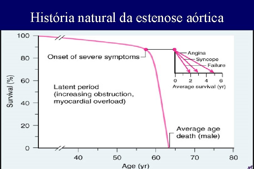 História natural da estenose aórtica História natural da estenose aórtica