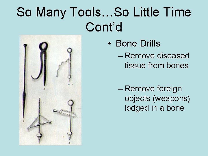 So Many Tools…So Little Time Cont’d • Bone Drills – Remove diseased tissue from