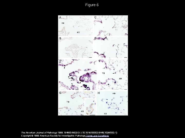 Figure 6 The American Journal of Pathology 1999 154853 -862 DOI: (10. 1016/S 0002