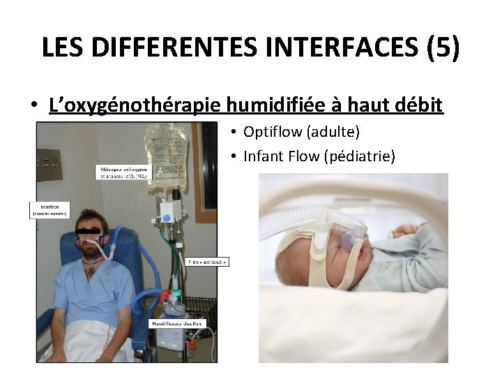 LES DIFFERENTES INTERFACES (5) • L’oxygénothérapie humidifiée à haut débit • Optiflow (adulte) •