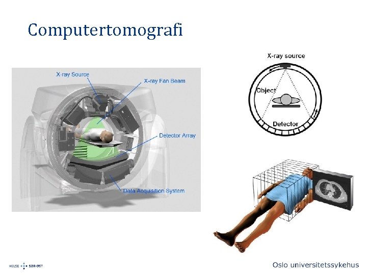 Computertomografi 