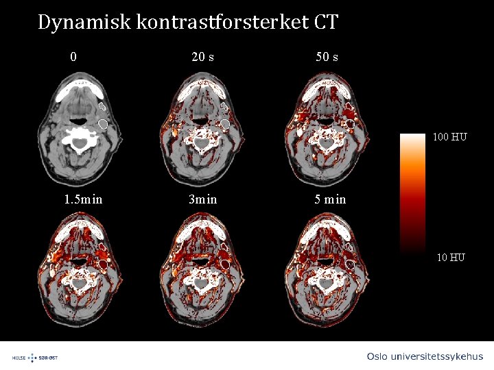 Dynamisk kontrastforsterket CT 0 20 s 50 s 100 HU 1. 5 min 3