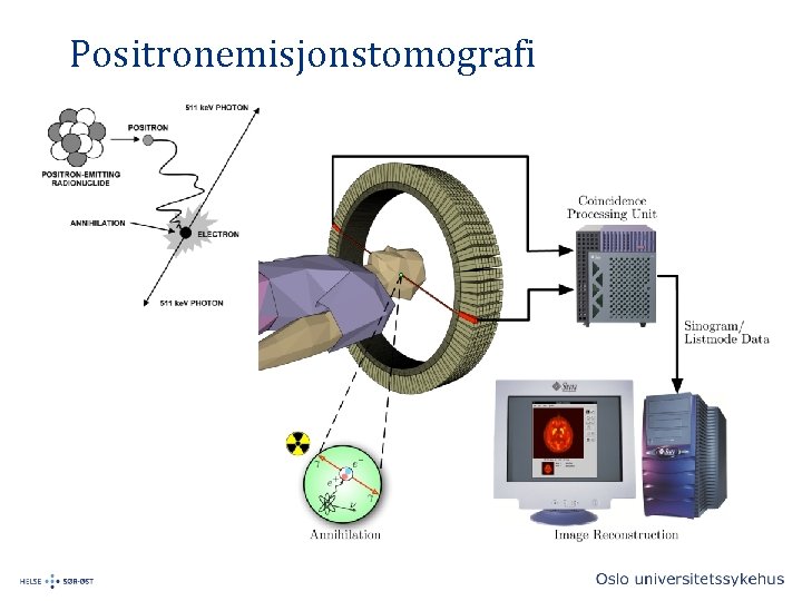 Positronemisjonstomografi 