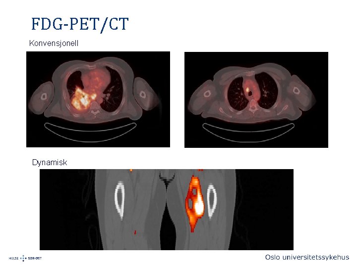 FDG-PET/CT Konvensjonell Dynamisk 