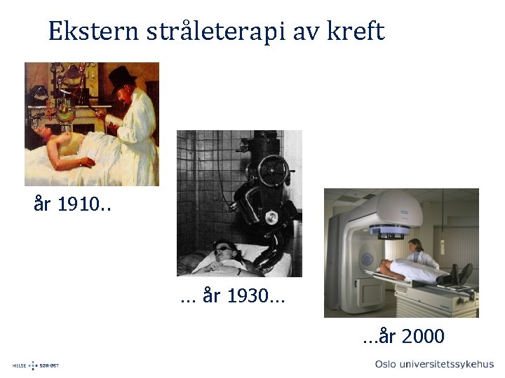 Ekstern stråleterapi av kreft år 1910. . … år 1930… …år 2000 