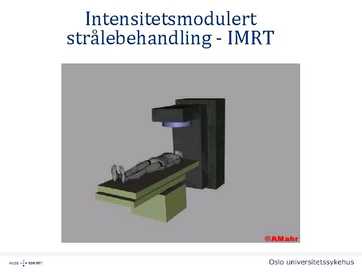 Intensitetsmodulert strålebehandling - IMRT 