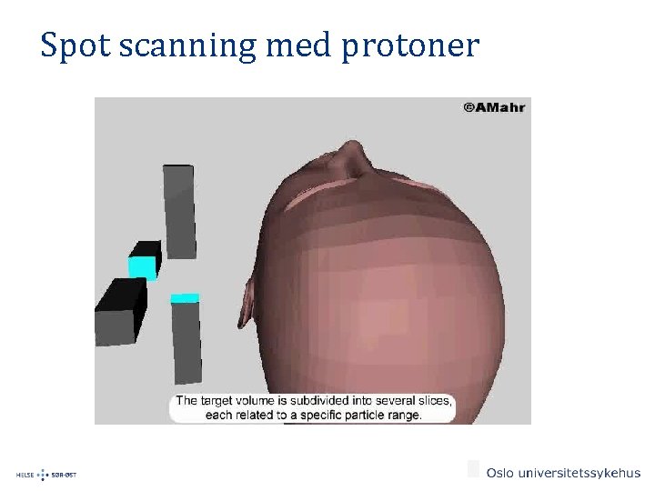 Spot scanning med protoner 