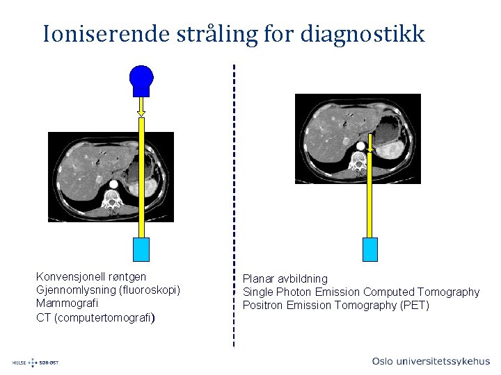 Ioniserende stråling for diagnostikk Konvensjonell røntgen Gjennomlysning (fluoroskopi) Mammografi CT (computertomografi) Planar avbildning Single
