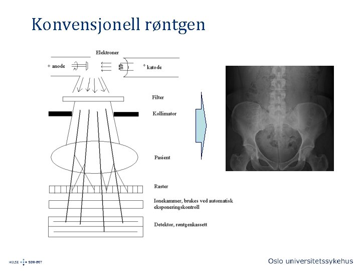 Konvensjonell røntgen 