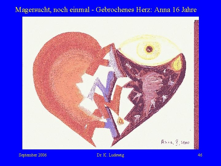 Magersucht, noch einmal - Gebrochenes Herz: Anna 16 Jahre September 2006 Dr. K. Ludewig