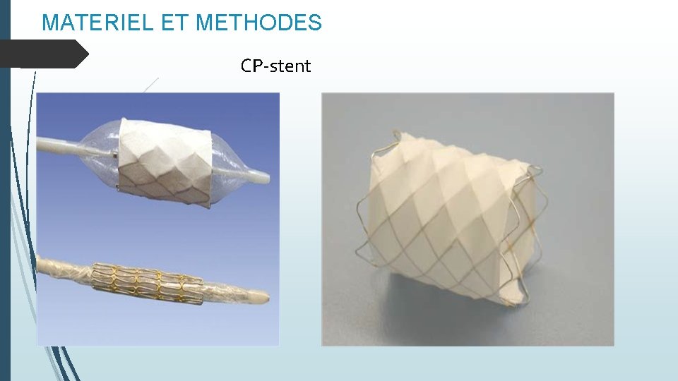 MATERIEL ET METHODES CP-stent 