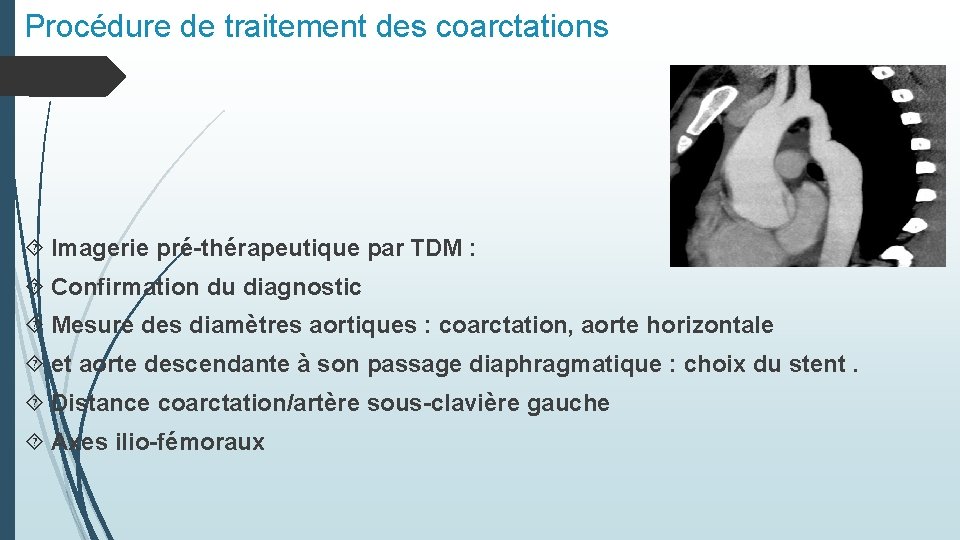 Procédure de traitement des coarctations Imagerie pré-thérapeutique par TDM : Confirmation du diagnostic Mesure