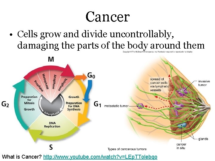 Cancer • Cells grow and divide uncontrollably, damaging the parts of the body around
