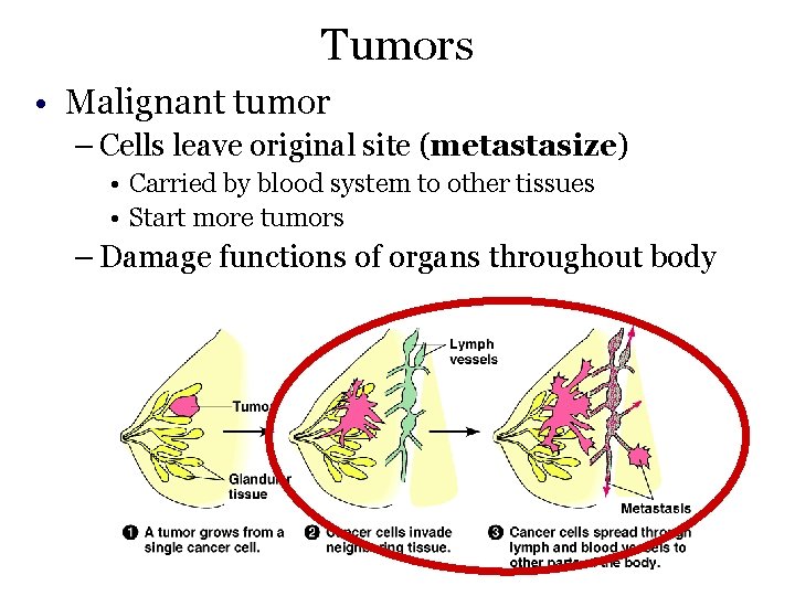 Tumors • Malignant tumor – Cells leave original site (metastasize) • Carried by blood